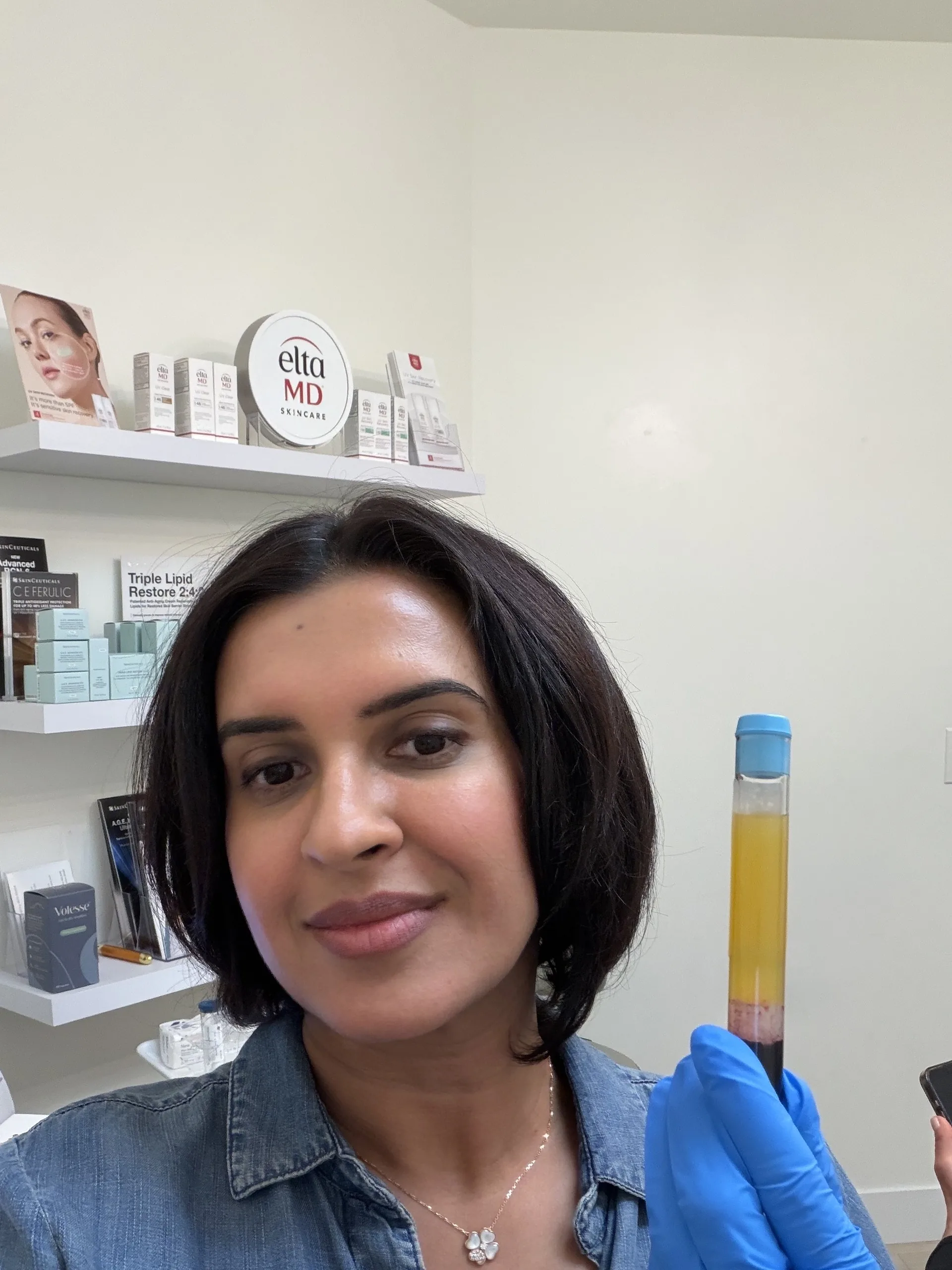 Dr. Inderpreet Sanghera holding a tube of processed blood, with the plasma layer on top