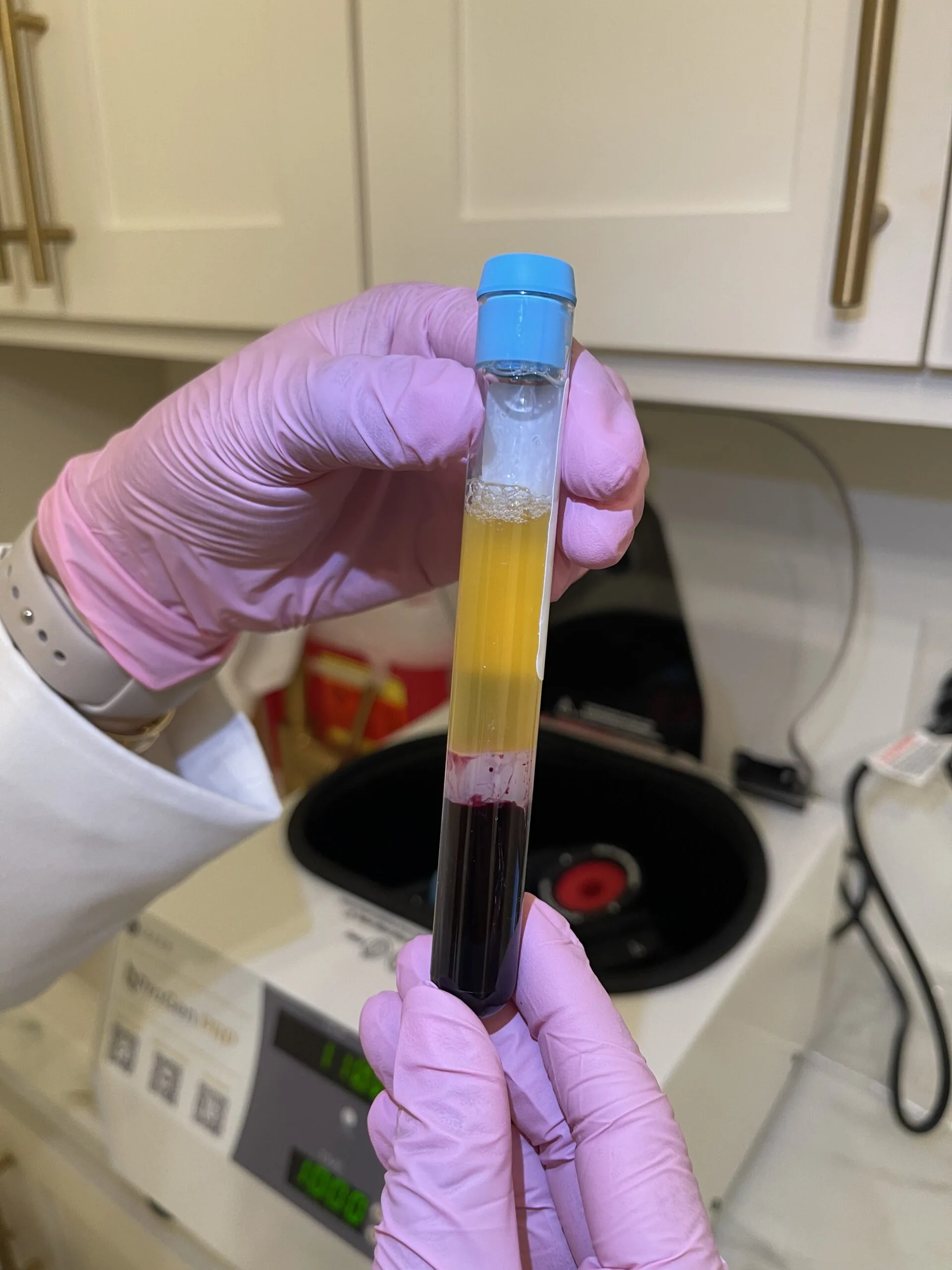 A gloved hand holding a tube of blood separated into plasma and red cells, in front of a centrifuge