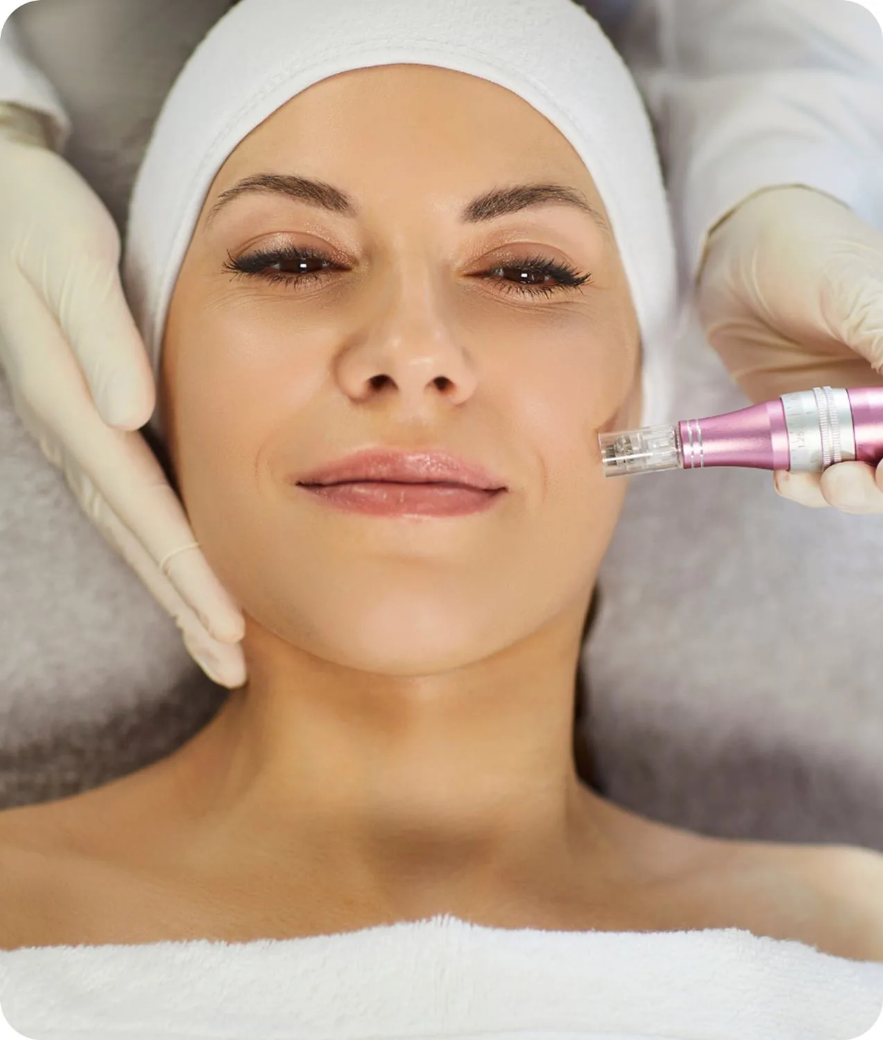 A microneedling pen being used on a woman's cheek
