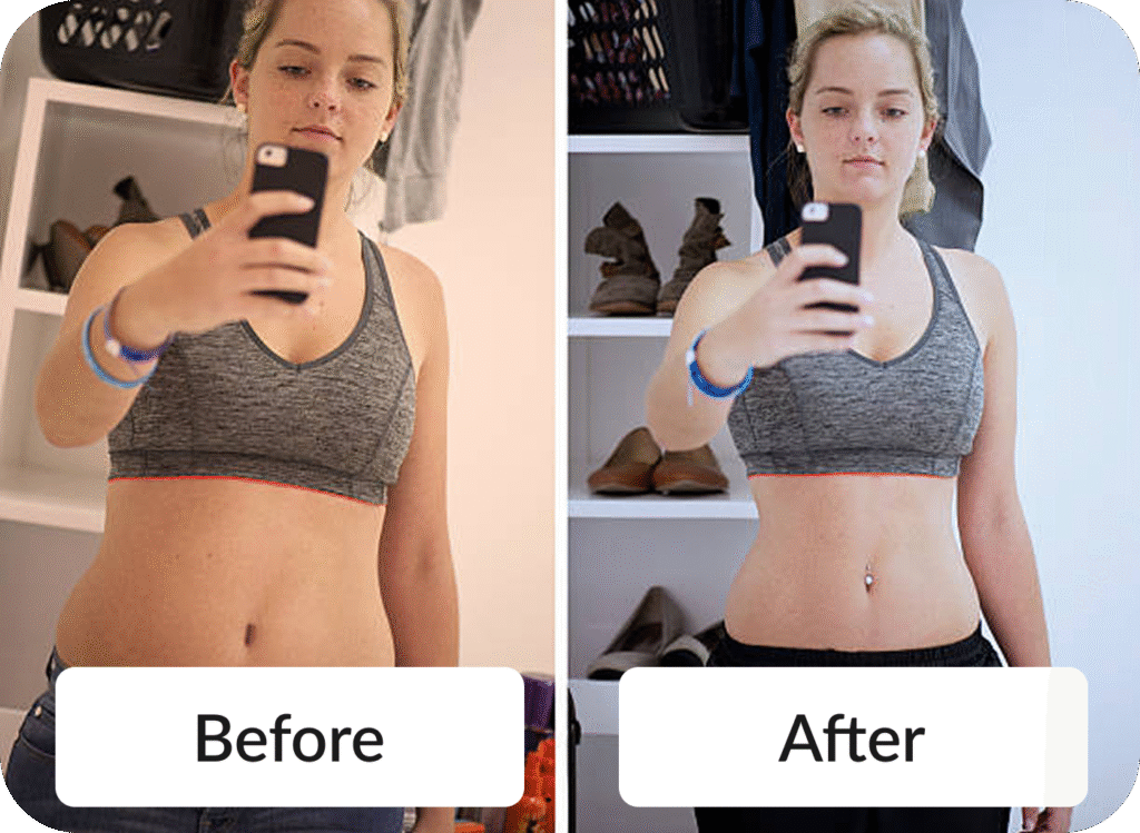 Medical Weight Loss - Before & After photo