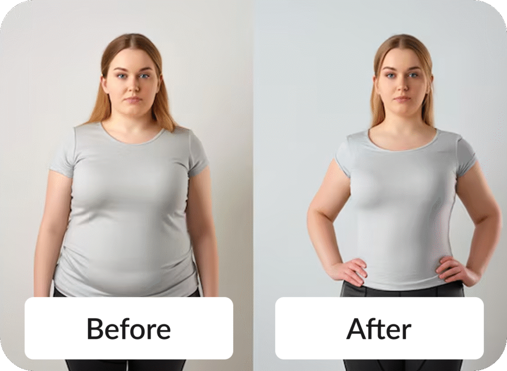 Medical Weight Loss - Before & After photo