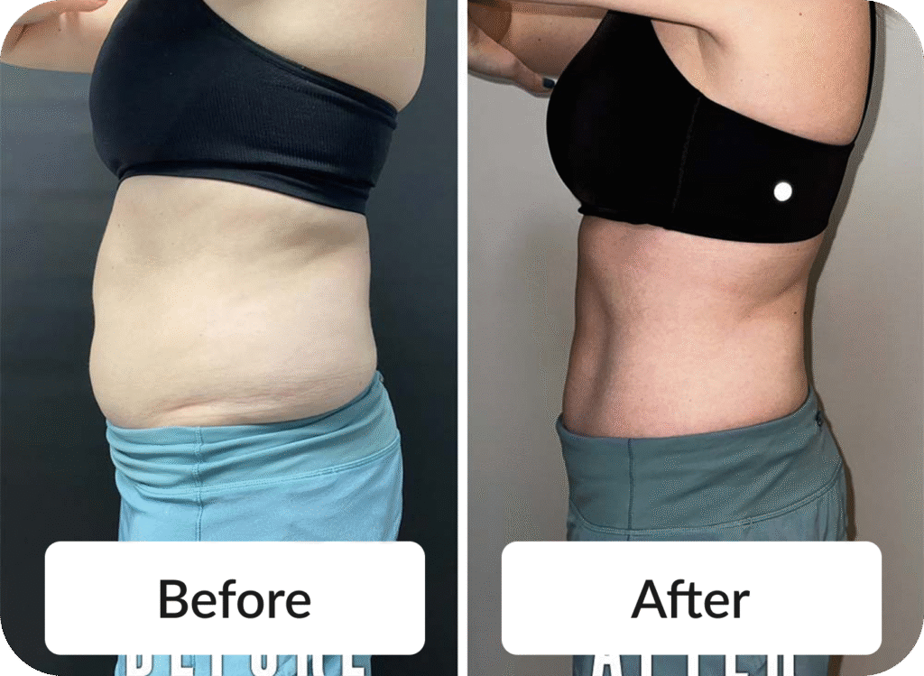 Medical Weight Loss - Before & After photo