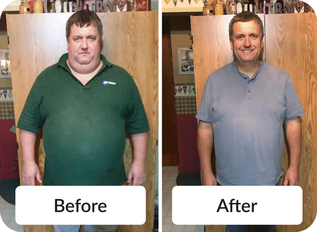 Medical Weight Loss - Before & After photo
