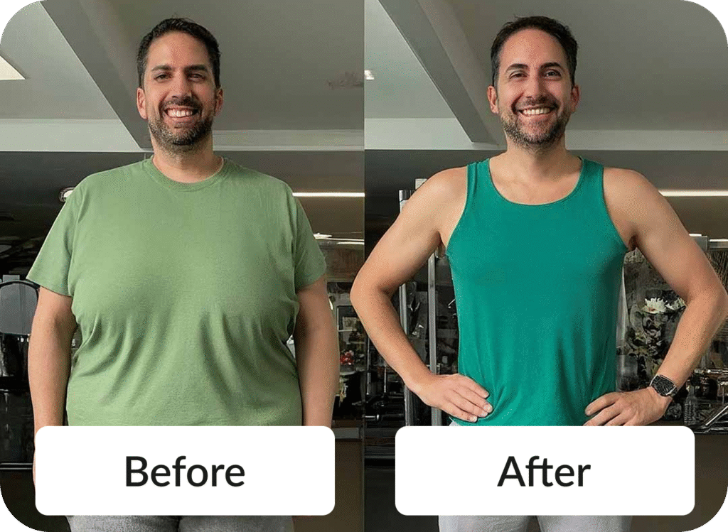 Medical Weight Loss - Before & After photo