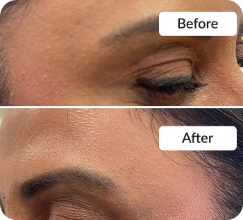 Skin treatment Before & After photo