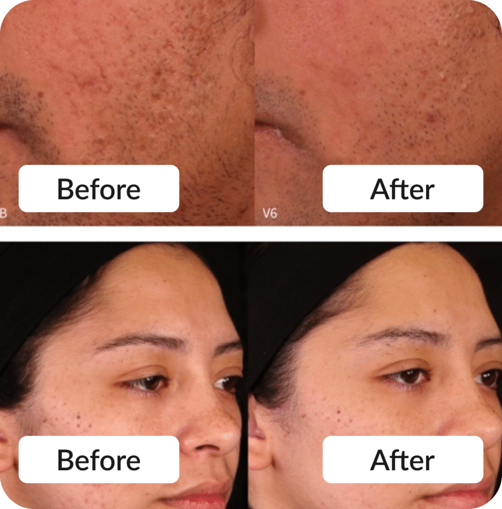 Skin treatment Before & After photo