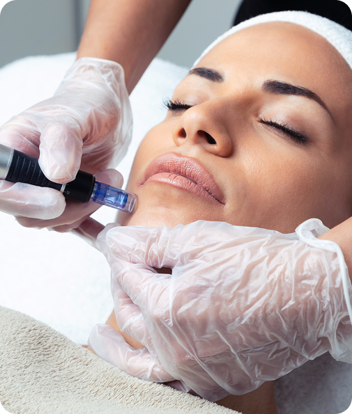 Microneedling PRP Before & After