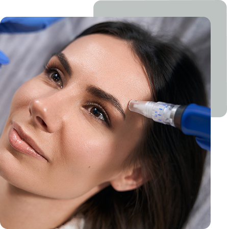 Microneedling Results