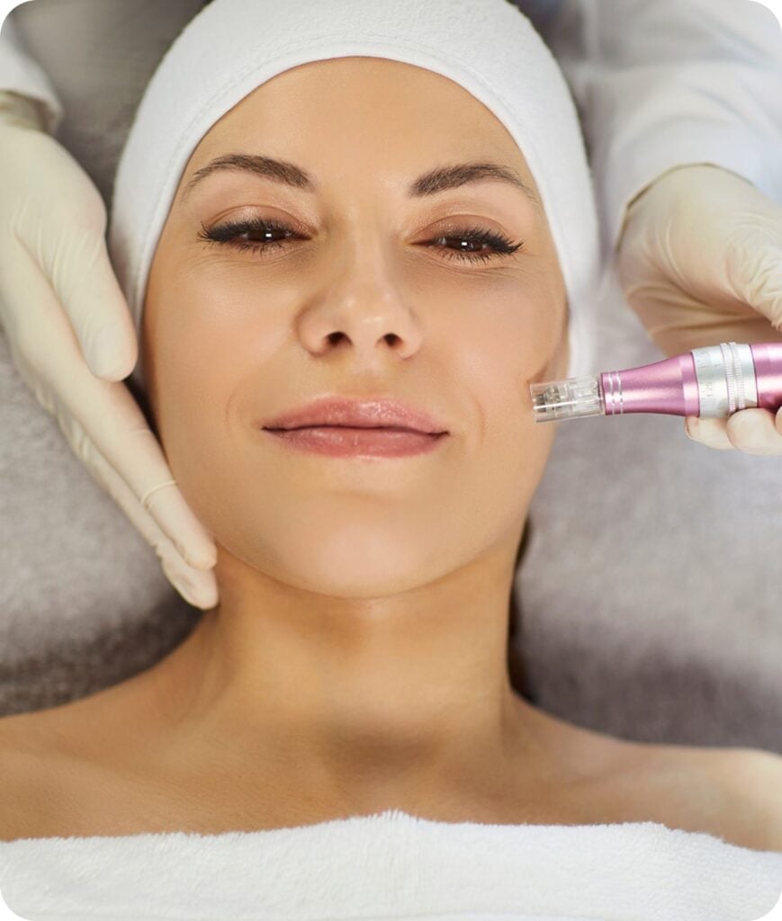 Microneedling Skin's Natural Renewal