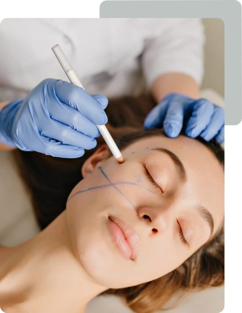 Microneedling for Roseville, CA