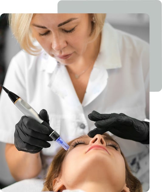 Microneedling Skin Regeneration